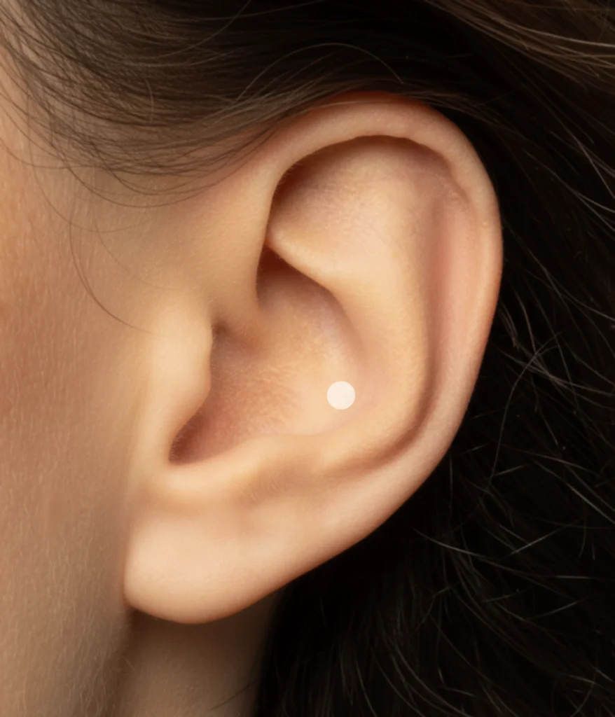 Emplacement du piercing au conch, zones repérées en points blancs